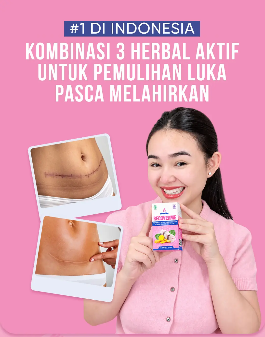 RecoverMe #1 Di Indonesia - Kombinasi 3 Herbal Aktif